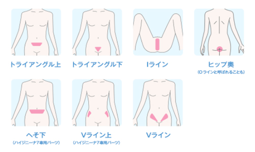 ミュゼのハイジニーナ7VIO脱毛コース