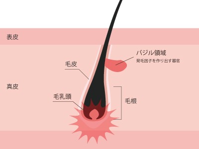 従来の脱毛方法